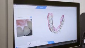 Primescan - высокоскоростной интраоральный сканер | Sirona (Германия)