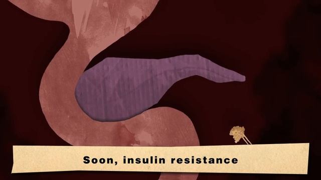 See Active Fat causing Type 2 diabetes смотреть онлайн