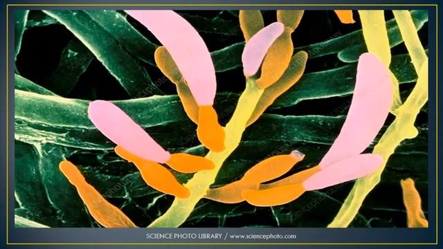 ZOOM JAMUR FUSARIUM PADA PISANG DENGAN MIKROSKOP ELEKTRON - DIRGA BIOLOGY CHANNEL смотреть онлайн