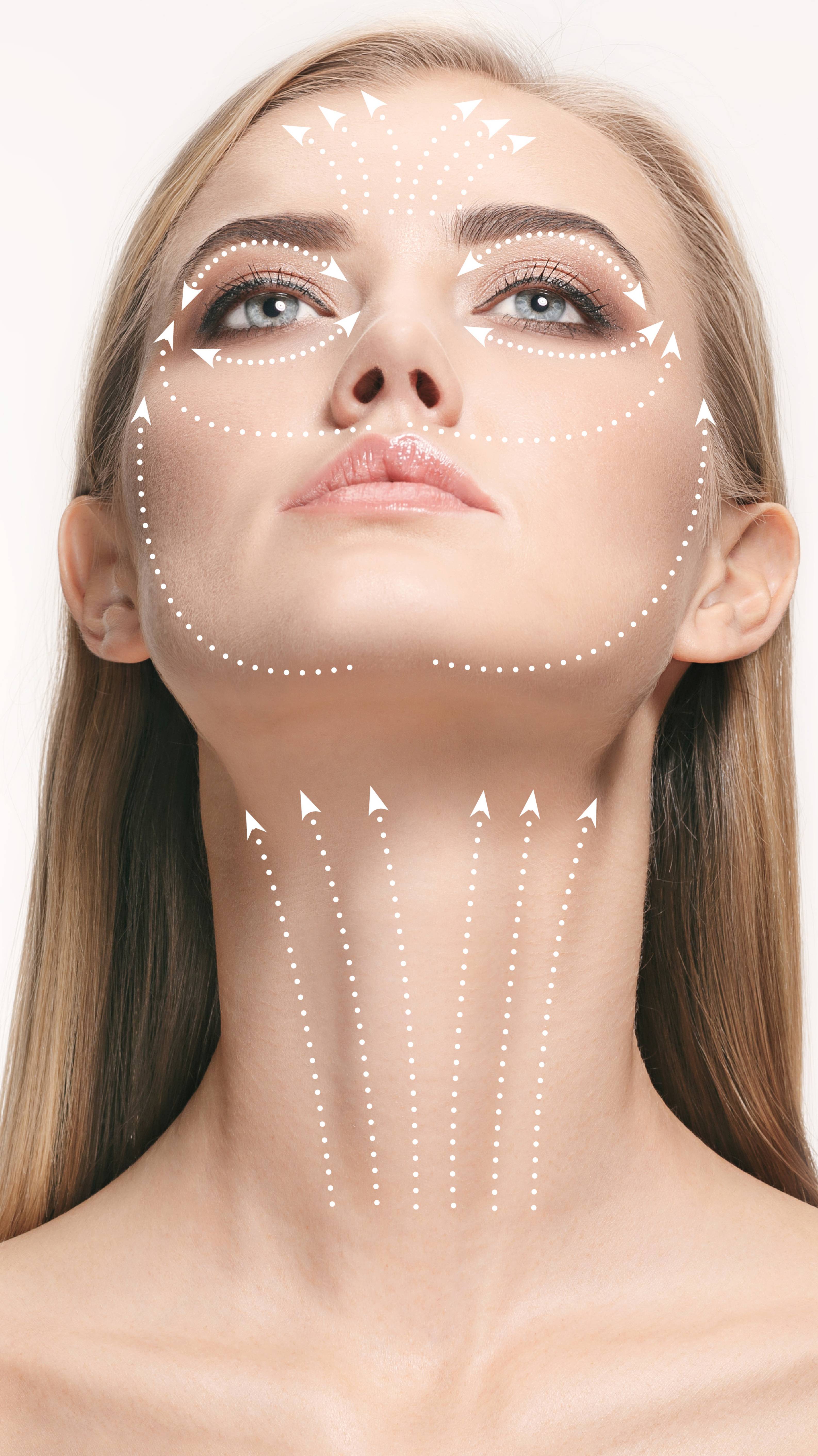 Секреты нитевого лифтинга смотреть онлайн