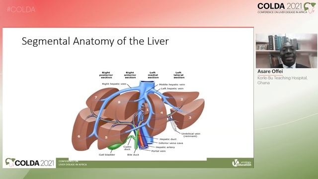 Surgical Treatment of HCC - Asare Offei, MBChB, MGCS, FWACS смотреть онлайн