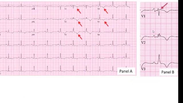 Clinical Round T2 E11 "para todo aquel que le guste la Cardiología" смотреть онлайн