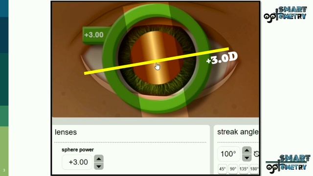 Cross Retinoscopy with Simulator (How practice with Simulator) смотреть онлайн