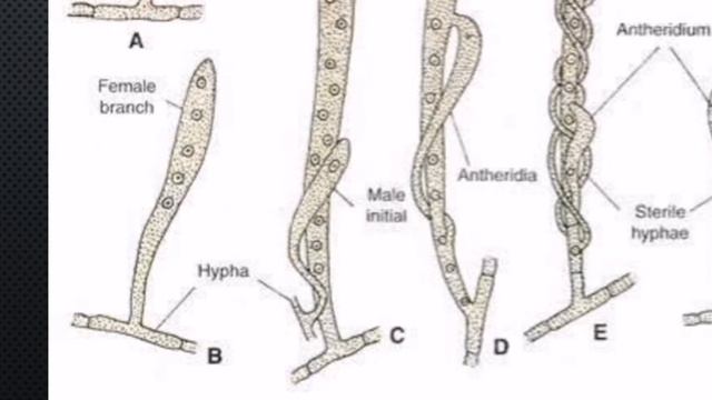 Penicillium General features and Reproduction смотреть онлайн