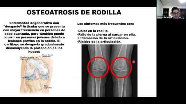 Problemas más frecuentes de la Rodilla смотреть онлайн