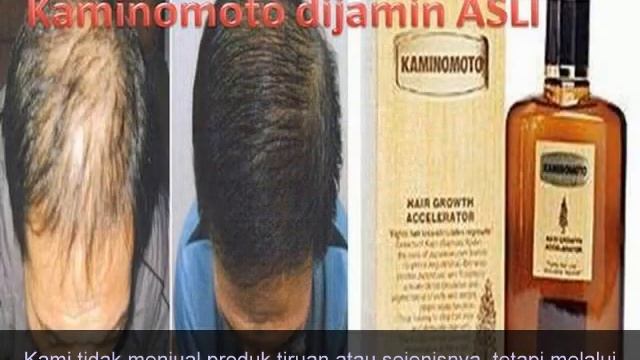 Penumbuh rambut ajaib смотреть онлайн
