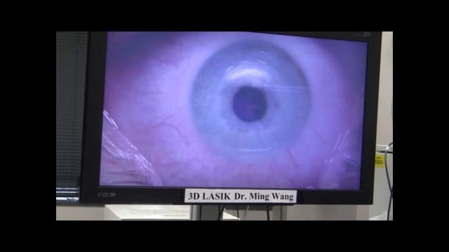 Marcy Throop 3D LASIK done by Dr Ming Wang, Harvard MD magna cum laude & MIT PhD laser physics смотреть онлайн