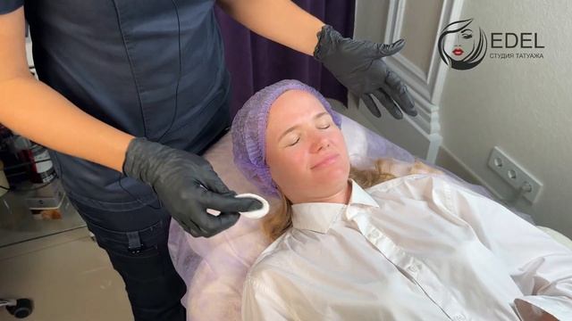 Как Выглядят Губы Через Год После Увеличения. Повторное Увеличение Губ Через 1 год смотреть онлайн