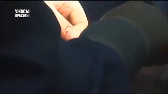 Ужасы красоты. Выпуск 23 ► "Самая полезная программа" смотреть онлайн