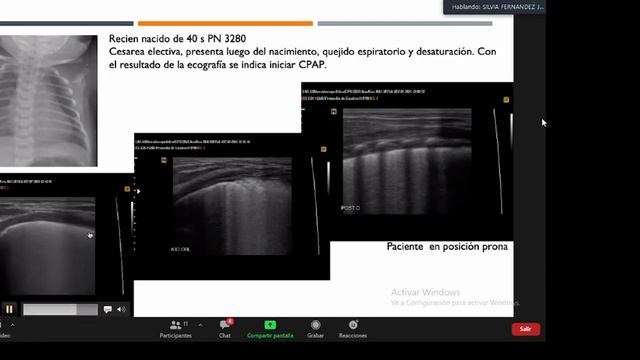ECOGRAFIA PULMONAR EN NEONATOLOGIA смотреть онлайн