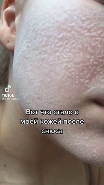 К ЧЕМУ ПРИВОДИТ УПОТРЕБЛЕНИЕ СНЮСА😭😭😭 смотреть онлайн