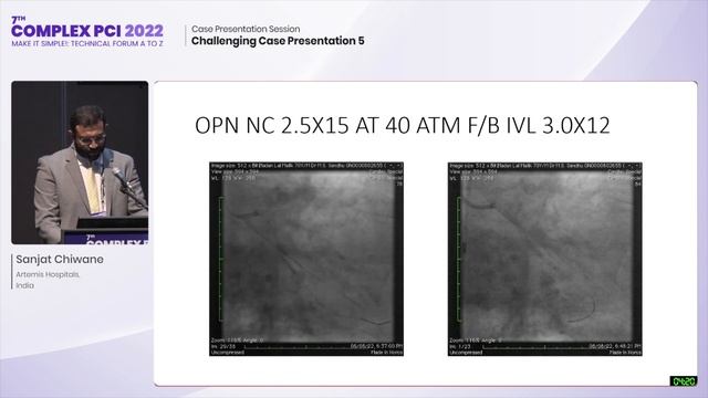 [COMPLEX PCI 2022] Challenging Case Presentation 5 смотреть онлайн