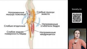 К каким болям приводит наклон таза