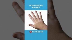 Ок догларни даволаш учун табиий воситадан фойдаланинг Oq dog'larni davolash