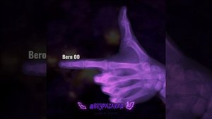 Bero 00(Speed Up)