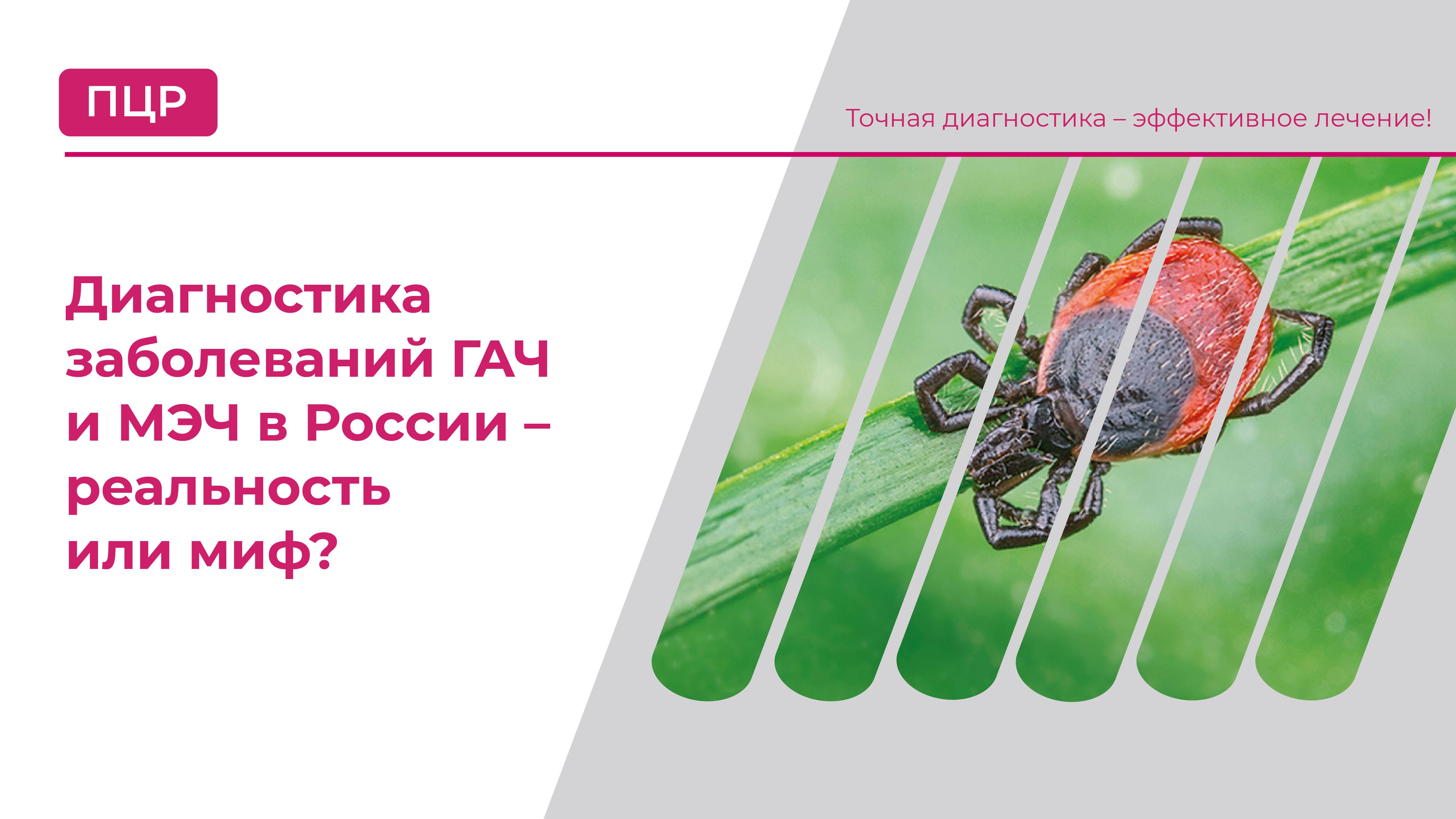 Диагностика заболеваний ГАЧ и МЭЧ в России – реальность или миф?