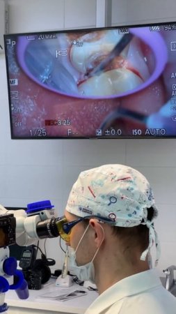 Teeth prep + Zeiss , Lite touch Er YAG, diode Laser Picasso, Prime Scan