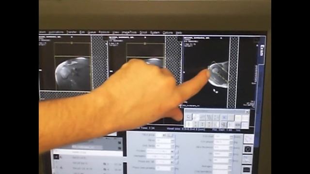 MRI SHOULDER