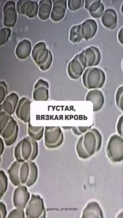 Сколько и какую воду вы пьете?