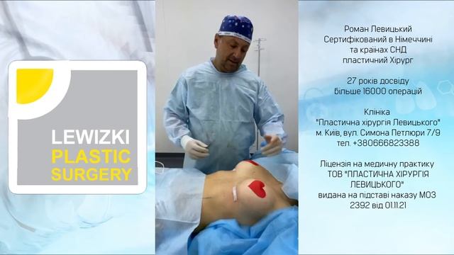 Збільшення грудей І Красиві груди І Збільшення грудей імплантами І Протезування молочних залоз смотреть онлайн