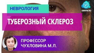 Профессор Чухловина М.Л.: Туберозный склероз