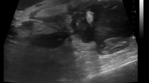 Новообразование тощей кишки и перфорация кишечника на УЗИ у кошки