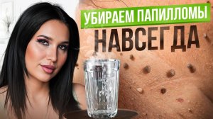 3 простых способа избавиться от ПАПИЛЛОМ в домашних условиях!