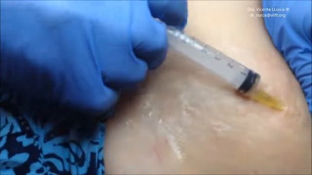 JBP "Nano"concept French смотреть онлайн