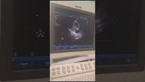 Аккредитация УЗИ ЭХО