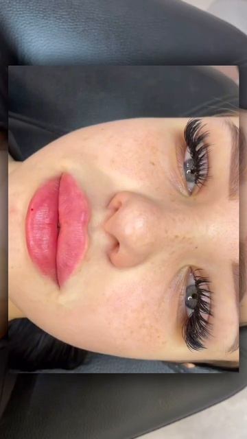 Контурная пластика губ 💉 stylage 
Краснодар