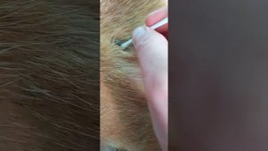 Как быстро достать клеща.