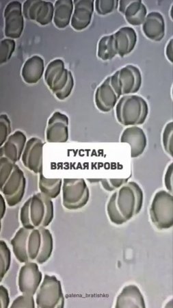 Сколько и какую воду вы пьете?