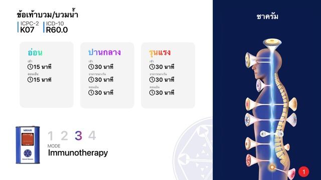 K07 ข้อเท้าบวม/บวมน้ำ ( ICD-10: R60.0 ) - ใบสั่งยา MIRARI® смотреть онлайн