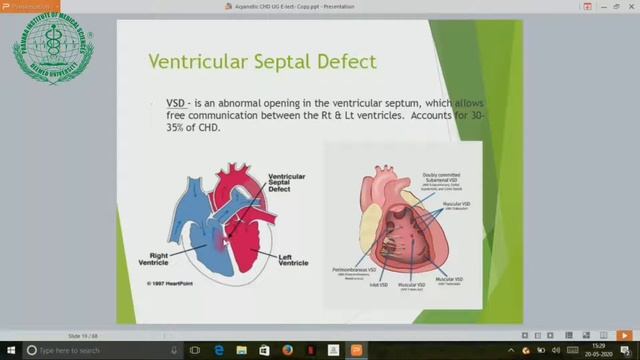 Acynotic Congenital Heart defeet Part- I смотреть онлайн