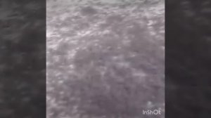 Смерть от муравьев смерти