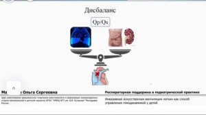 Управление гемодинамикой на ИВЛ Мальцева О.С. 2023