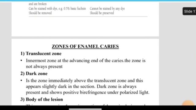 Question Paper Discussion-Conservative Dentistry & Endodontics-Part 1 смотреть онлайн