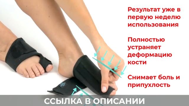 Магнитная вальгусная шина MagnetFix