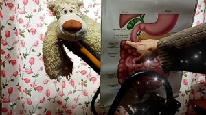 Опущение ЖКТ кишечника и Инверсионный стол-профилактика рака❤️YouCut_20250205_110338430.mp4