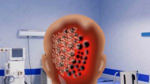 Shocking ASMR: Removing Dog Ticks & Maggots in Deep Cleaning Animation