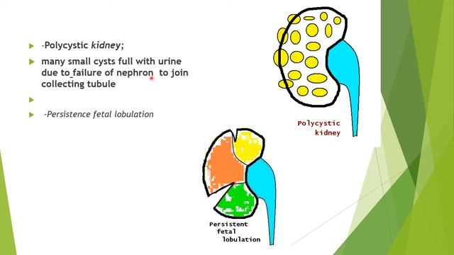 Development of the kidney and ureter -post graduate genitourinary смотреть онлайн