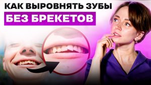 КАК ИСПРАВИТЬ КРИВЫЕ ЗУБЫ БЕЗ БРЕКЕТОВ?