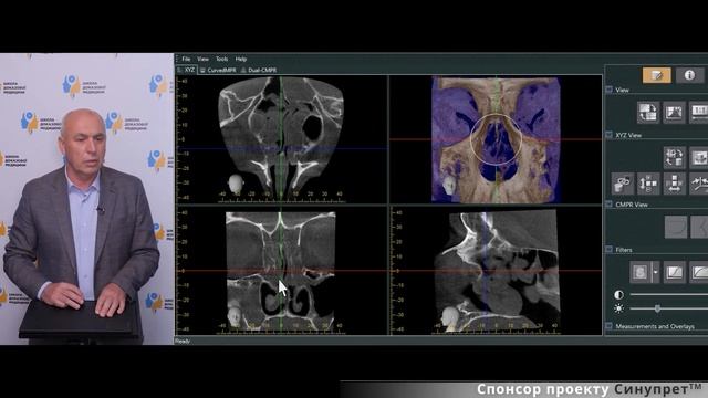 Клінічний випадок: цілорічний алергічний риніт смотреть онлайн
