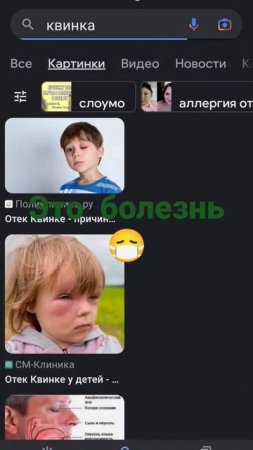 свинка это болезнь то значит....