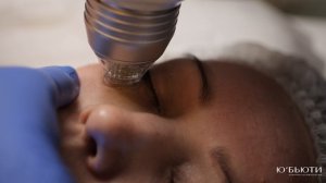 Микроигольчатый RF-лифтинг на аппарате Инус