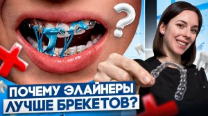 Выравнивают ли элайнеры зубы? ТОП 5 ПРИЧИН установить ЭЛАЙНЕРЫ, вместо брекетов!