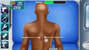 ASMR Spine Surgery Treatment Animation| Back Bone Crack Fracture Recovery Surgery Anatomy