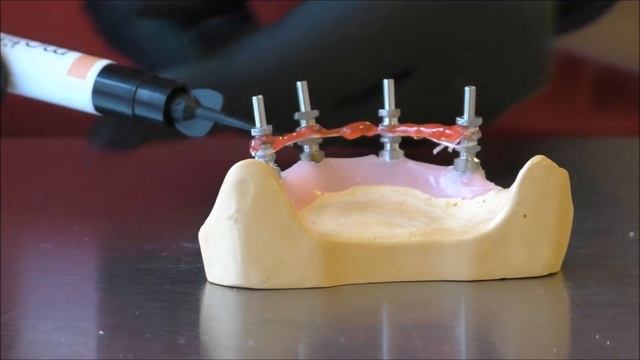 Mode Implant Quattrofix Prosthesis