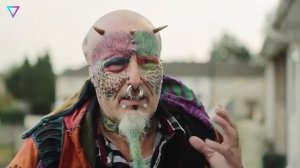 ▽ Самые удивительные изменения человека с помощью пластической хирургии