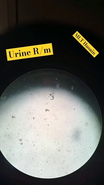 urine routine Analyse #viral #lab #trending #mltr #india